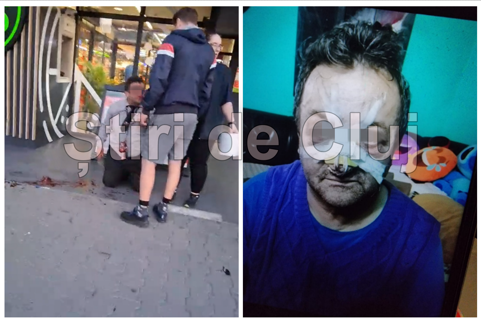EXCLUSIV VIDEO. Paznicul din Florești, bătut și lăsat într-o baltă de sânge după ce a oprit un furt, a ieșit din spital:„M-a desfigurat. M-am întors acasă”